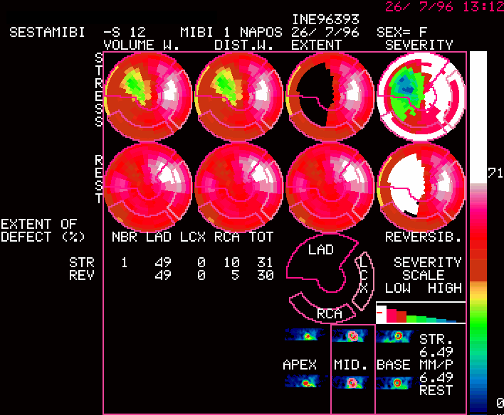 Pol�ris t�rk�p