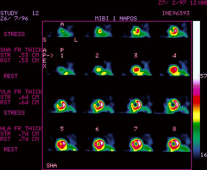 R�vid tengelyi metszetek /1