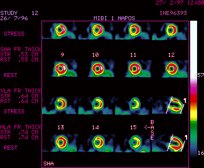 R�vid tengelyi metszetek /2