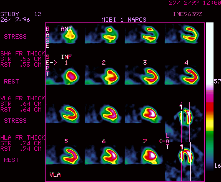 F�gg�leges hossz� tengelyi metszetek