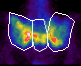 Ter�let-kijel�l�s sacroiliacalis indexhez